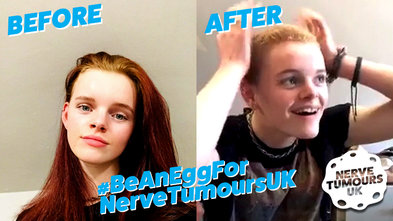 Before & After Photo